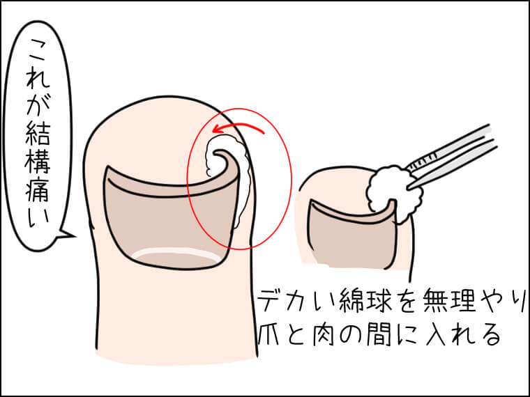 イラストエッセー　毎日がエンタメ　児玉愛子　さわ　ソウル旅行　巻き爪