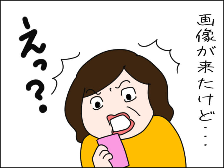 イラストエッセー 毎日がエンタメ 結膜炎