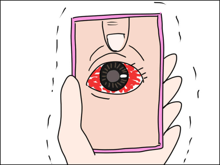 イラストエッセイ 毎日がエンタメ 結膜炎 ドタキャン