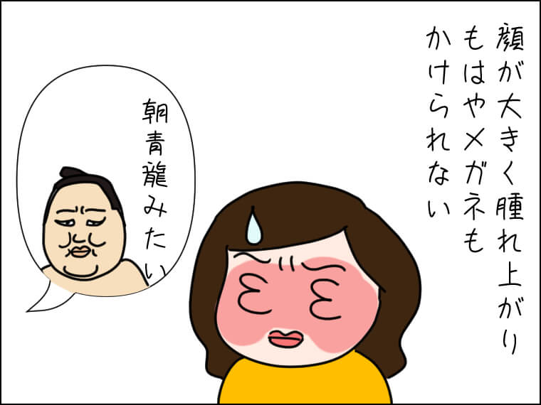 イラストエッセー 毎日がエンタメ 韓国美容 レーザー ダウンタイム